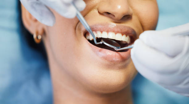 Best Emergency Wisdom Tooth Extraction in Fenton, MI