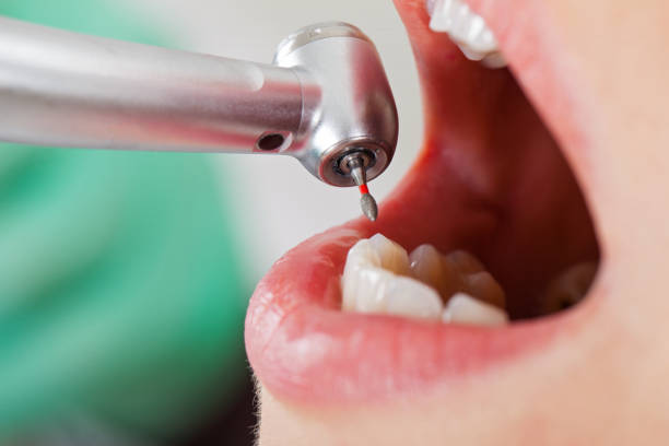 Best Walk-In Emergency Dental Services in Fenton, MI